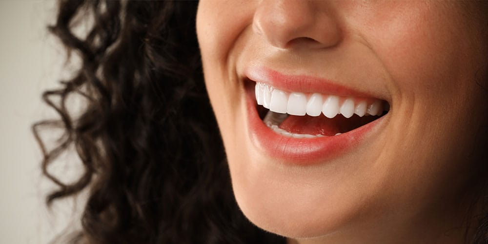 woman's smile after getting prepless veneers in Los Angeles, CA